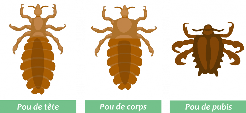 Poux Du Pubis Pou Du Pubis Faits Alimentation Habitat Photos Sur Poux Du Pubis Pou Du Pubis Faits Alimentation Habitat Photos Sur